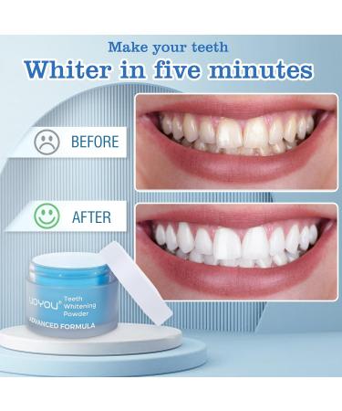 Teeth Whitening Powder for 6 Months Supply | Remove Tea, Coffee, Wine & Smoking Stains | Non-Sensitive Formula | Cool Mint - Buy Online on GoSupps.com
