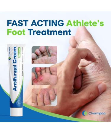 Athletes Foot Treatment Antifungal Cream Anti Fungus Skin Cream Extra Strength Athletes Foot Cream for Men Ringworm Antifungal Cream Fast Relief for Jock Inch & Fungal Infections(1pack) - Buy Online on GoSupps.com