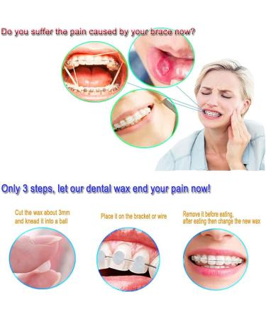 Dental Care Orthodontic Wax for Braces - 20 Pieces 10 Colors | Best for Comfort & Protection - Buy Online on GoSupps.com