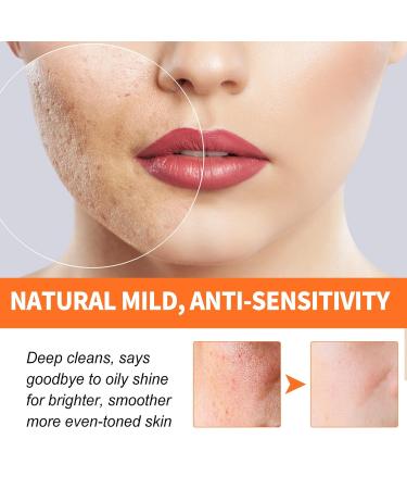 KVVS Carrot Extract Bubble Facial Mask - Blackhead Removal and Deep Cleaning for All Skin Types - Buy Online on GoSupps.com