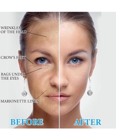 Buy Botox Facial Serum - Anti-Aging Vitamin C & Collagen Solution for Women | Reduce Fine Lines & Wrinkles | Nourish & Plump Skin - Buy Online on GoSupps.com