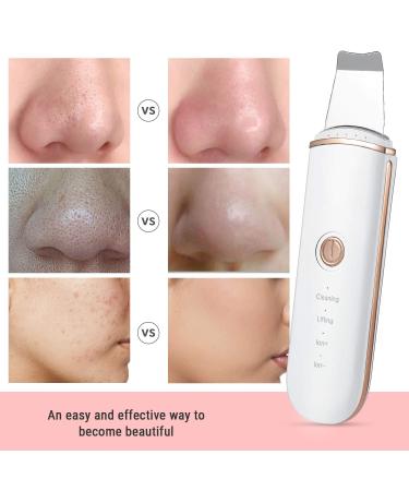 Skin Scrubber and Spatula Set with 4 Modes | Pore Cleanser, Blackhead Remover, Exfoliator | Includes 4 Acne Removal Tools - Buy Online on GoSupps.com