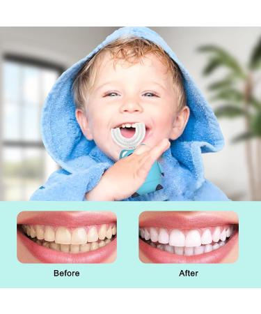 Kids Ultrasonic Electric Toothbrush with 360 Cleaning | Toddler's U Shaped Toothbrush with 3 Brushing Heads and Cup | Children's Oral Care Solution - Buy Online on GoSupps.com