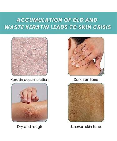 sjfscqr Original Skin So Soft Bath Oil Moisturizing Skin Smoothing and Softening Dry or Rough Skin Bath Oil for Smooth Skin for Women and Men - Buy Online on GoSupps.com