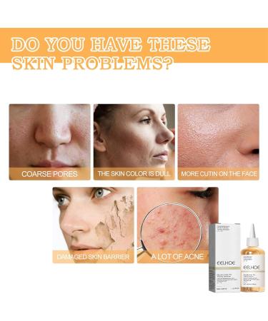 Glycolic Acid 7% Toner Glycolic Acid Toner for Face Repair Acne & Anti Aging Face Toner - Brightening & Facial Exfoliation Prevent Skin AgingImprove Blemishes Astringe Pores 1# - Buy Online on GoSupps.com