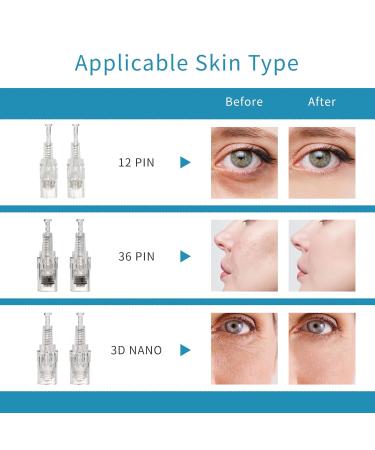 Buy CARER SPARK Microneedle Device - Adjustable 0.25mm to 2mm 10x36 Needle Length International Shipping - Buy Online on GoSupps.com