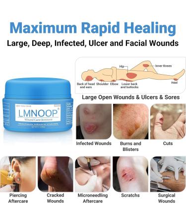 LMNOOP Wound Care Cream 1.1oz - First Aid Skin Repair Ointment for Infection Ulcers, Cuts, Scrapes, Burns, Bites & Surgical Wounds - Buy Online on GoSupps.com