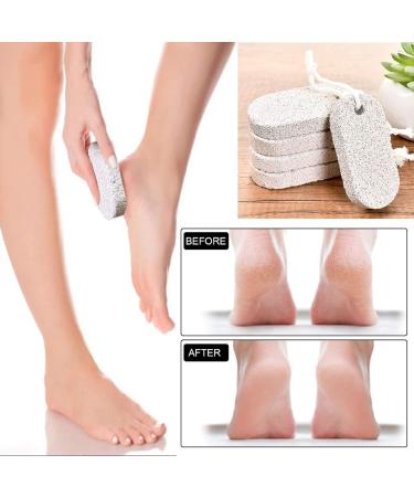 Pumice Stone Foot Scrubber Set - Callus Remover for Exfoliation | 4PCS Foot File for Feet, Hands & Body - Buy Online on GoSupps.com
