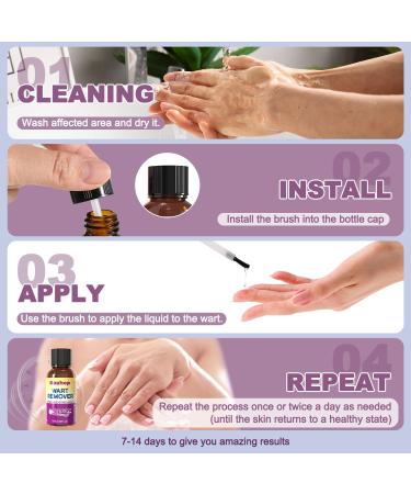 Liquid Wart & Corn Gel 30ml | Maximum Strength Salicylic Acid for Fast-Acting Wart Removal | Safe for Kids & Adults | International Shipping Available - Buy Online on GoSupps.com