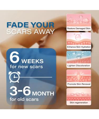 KELODA Keloid Scar Care Butter Stick - Surgical Scars & Keloids Removal Balm with Cocoa & Shea Butter - For Stretch Marks, Acne, Piercings | Coconut & Jojoba Oils - Effective Anti-Scar Treatment - Buy Online on GoSupps.com