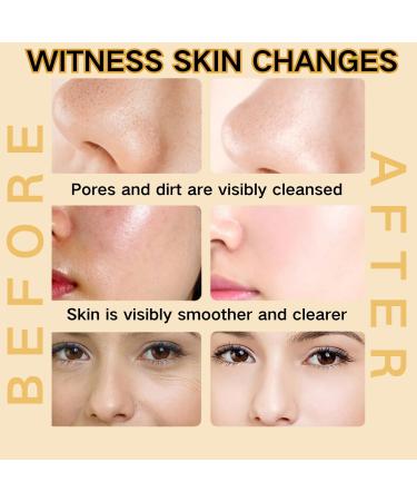 Turmeric Clay Mask - Face Masks Skincare - Hydrating Face Mask for Dark Spots - Even out Skin Tone Face Care - Vitamin C Clay Face Mask Control Oil and Refining Pores - Buy Online on GoSupps.com