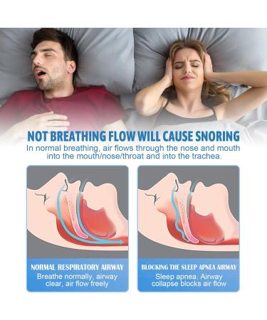 Anti-Snoring Chin Strap & Snoring Stopper Set - Effective Solutions to Reduce Snoring Noises - Buy Online on GoSupps.com