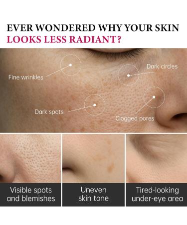 2Pcs Arbutin 7% + Tranexamic Acid 4% Cream 70 000ppm Arbutin & 40 000ppm TXA Moisturizing Hydrating Even Skin Tone Reduces Dark Spots & Pigmentation - Buy Online on GoSupps.com