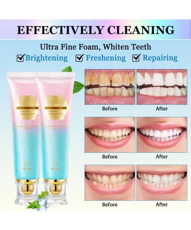 2 Pack Niacinamide Whitening Toothpaste Niacinamide Toothpaste Fresh Breath Toothpastes Remove Tooth Stains 7.6 Oz - Buy Online on GoSupps.com