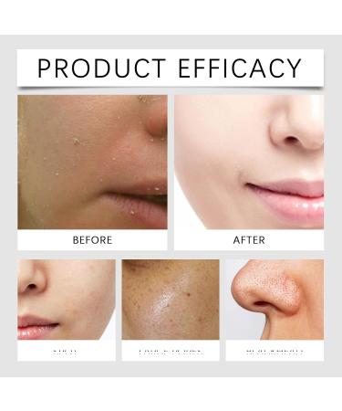 QPJUVC Travel serum for the face antiwrinkle and whitening serum with hyaluronic acid niacinamide and vitamin B moisturizing for fair and dry skin nourishing essence 5 - Buy Online on GoSupps.com