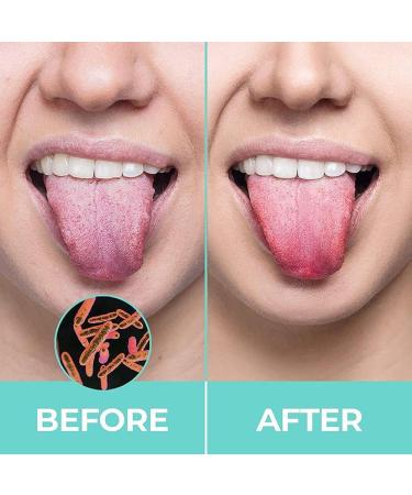 Buy Wmool Steel Tongue Cleaner - Stainless Metal Toothbrush for Oral Hygiene | Adult Tongue Scraper & Brush - Buy Online on GoSupps.com