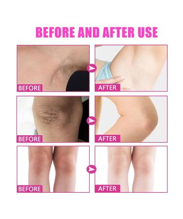 Go Ho 2PCS Dark Spot Remover - Vitamin C Cream for Face Body & More | Effective Blench Lotion & Dark Spots Corrector - Buy Online on GoSupps.com