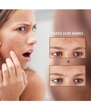  Sentechx Blusoms Clearacne Defense Natural Gel with Organic Aloe Vera Aloe Vera Moisturizer Acne Treatment for Face Suitable for All Skin Types - Buy Online on GoSupps.com