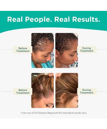 Shapiro MD Women's Hair Regrowth Travel Kit - 2% Minoxidil Leave-In Foamer for Healthier, Fuller, Thicker Hair - Buy Online on GoSupps.com