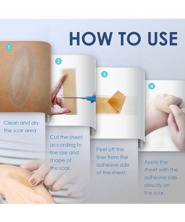 Scar Away Silicone Scar Sheets - Advanced Formula for Fast Scar Removal - 5.9*1.6'' Scar Tape Strips - Buy Online on GoSupps.com