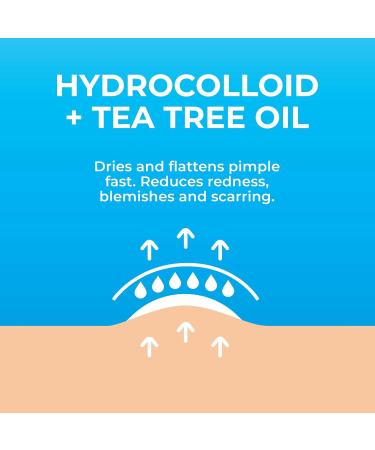 KEYCONCEPTS Pimple Patches for Face - 500 Hydrocolloid Acne Patches with Tea Tree Oil - Effective Zit Stickers for Acne Treatment - Fast Shipping Internationally - Buy Online on GoSupps.com
