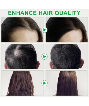 Raw Batana Oil for Hair Growth | 100% Pure Organic from Honduras | Prevent Hair Loss & Enhance Thickness | 4 FL OZ - Buy Online on GoSupps.com