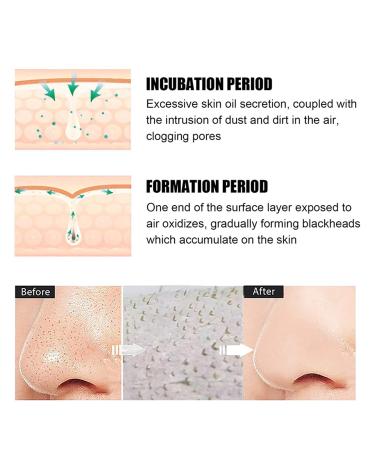 Green Tea Blackhead Remover & Charcoal Peel Off Mask | Deep Cleaning Pore Cream for All Skin Types | Oil Control & Purifying Skin Care - Buy Online on GoSupps.com