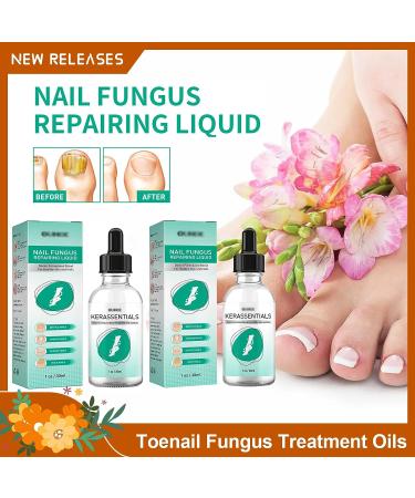 Kerassentials Toenail Treatment - Repair Damaged Toenails (2PCS*30ML) - Buy Online on GoSupps.com