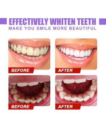 Buy 2 Pieces Tooth Cleaning Toothpaste - V34 Color Corrector & Sensitive Teeth Formula | International Shipping - Buy Online on GoSupps.com