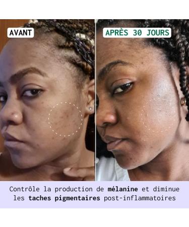 NUBIANCE - Anti-Dark Spot Cream HRB-3: Hyperpigmentation Corrector Day & Night - Unifying Moisturizing SPF30 Black & Combination Skin Pigment Spots - Buy Online on GoSupps.com