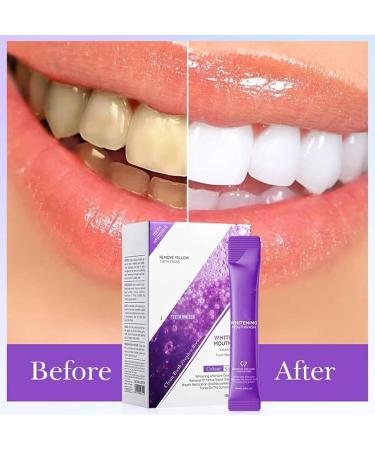 Purple Teeth Whitening Mouthwash - 20 Pcs Box | Best Rinse for Whitening & Fresh Breath - Buy Online on GoSupps.com