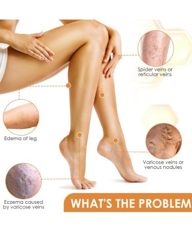  Elitecran Varicose Vein Cream with Bee Poison Varicose Vein Treatment Cream for Legs Repairing Balm for - Buy Online on GoSupps.com