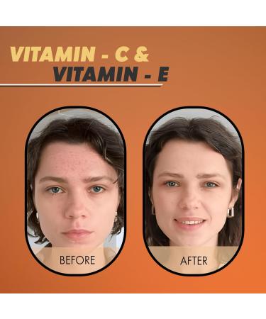 IYASA 5% Vitamin C Serum - Anti-Aging & Skin Brightening Hydrate & Plump Skin Reduce Dark Spots - 30ml - Buy Online on GoSupps.com
