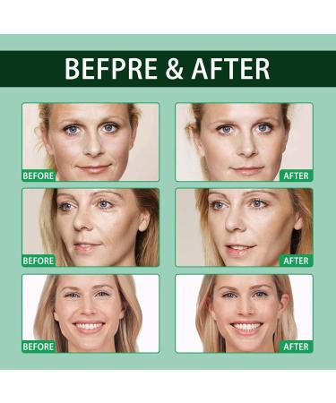 Luxury Hyaluronic Acid Anti-Aging Serum - Collagen Boost, Brightening & Anti-Wrinkle Formula for Fighting Dark Spots and Fine Lines (3PC) - Buy Online on GoSupps.com