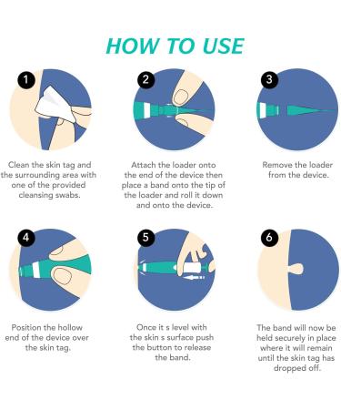 2 in 1 Skin Tag Remover Pen for Small to Large Skin Tags - Painless Wart Removal Device - Easy Tag Removal Kit - Green - Buy Online on GoSupps.com