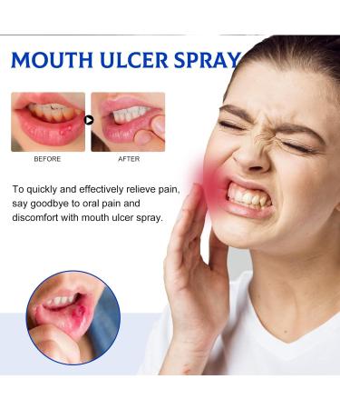 Herbal Oral Ulcer & Canker Relief Spray 30ML | Dry Mouth & Oral Care Solution - Buy Online on GoSupps.com