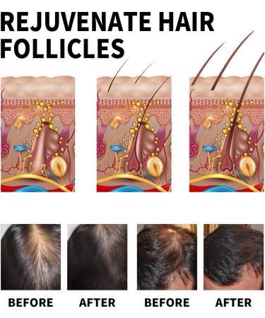 MagiForeign Hair growth serum rosemary oil accelerates hair growth with rosemary for hair growth oil massage the scalp to care for the hair prevents hair loss for men and women 60 ml - Buy Online on GoSupps.com