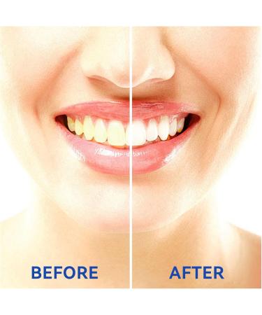 Xnivuis 260 Interdental Brushes & Silicone Tooth Picks for Braces - Effective Mouth Cleaning Tools in Blue - Buy Online on GoSupps.com