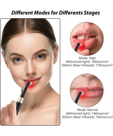 Portable Red Light Therapy Device for Lip Herpes and Canker Sore Treatment - Reduce Pain and Rejuvenate Skin | TL_06 - Buy Online on GoSupps.com