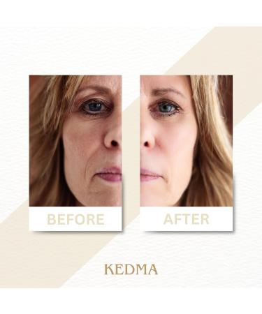 Kedma Instant Wrinkle Filler with Platinum and Hyaluronic Acid Smoothing and Moisturising For All Skin Types 10g - Buy Online on GoSupps.com
