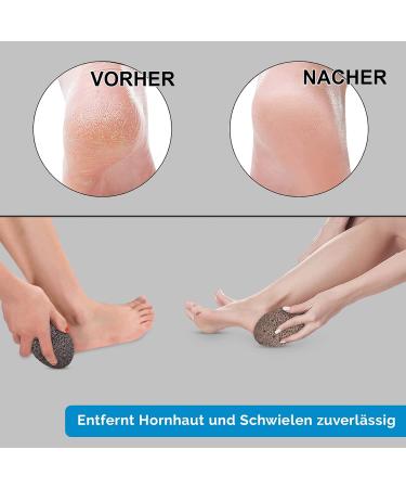 Holbeauty Bimsstein Foot Care - Natural Lava Stone Callus & Horn Skin Remover for Feet & Hands - Effective Pumice Stone Solution - Buy Online on GoSupps.com