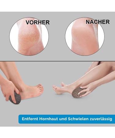 Holbeauty Bimsstein Foot Care Set - Natural Horn Skin & Callus Remover - Pumice Stone for Feet & Hands - Terracotta & Dark Terracotta Options - International Shipping Available - Buy Online on GoSupps.com