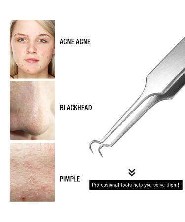 JewelryWe Stainless Steel Blackhead Remover & Pimple Clips - Curved Needle Tool for Clear Skin - Buy Online on GoSupps.com