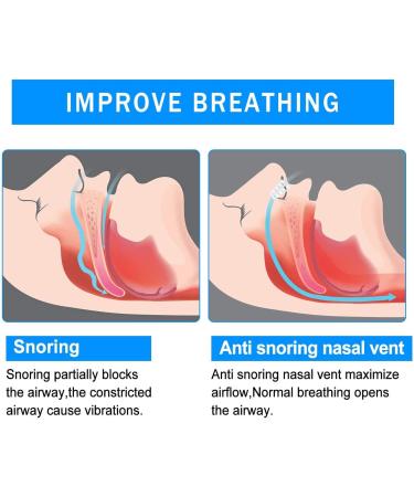 Anti Snoring Nose Vent 8 Pack - Breathing Relief Nasal Dilator with Different Size Vents - Includes Travel Case - Buy Online on GoSupps.com
