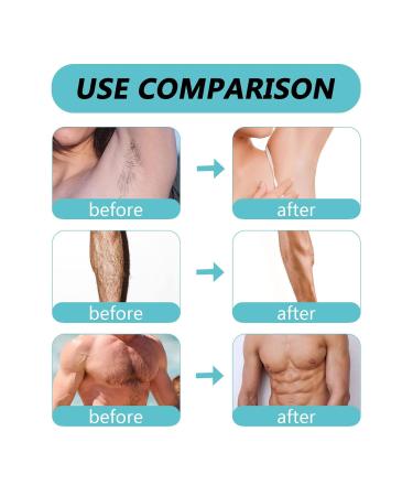 Sonew Roll-On Wax Warmer 40W | Portable Hair Removal Wax Heater with 2 x 100ml Soft Wax Cartridges | EU Plug 220V | Best Wax Depilatory Scooter for Smooth Skin - Buy Online on GoSupps.com
