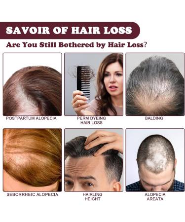 LINXINS Batana Oil for Hair Growth Raw Batana Oil Batana Oil Organic Botana Oil Repairs Damaged Hair Reduces Hair Loss - Miracle Oil for Healthier For Hair Growth (1PC - 120ml) - Buy Online on GoSupps.com