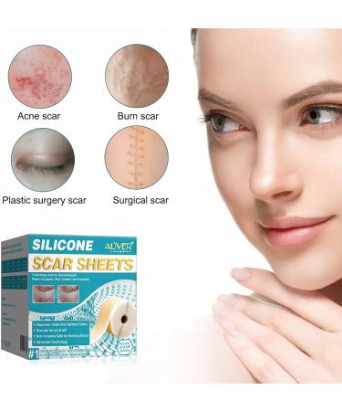 Silicone Surgical Scar Removal Patch for Trauma, Burn, Acne Treatment | Skin Repair Therapy - Buy Online on GoSupps.com