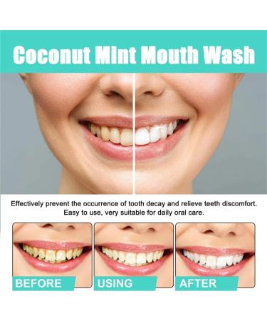 Oralhoe Coconut Mint Mouthwash - Travel Oil Extract Dental Care | 2PCS - Buy Online on GoSupps.com