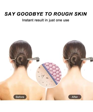 37 Exfoliating Back Scrubber with Handles - Body Exfoliator Bath Tool for Deep Scrubbing - Men & Women (Pink - Buy Online on GoSupps.com