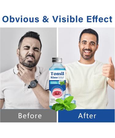 Tonsil Stone Remover - Natural Alcohol-Free Mouthwash for Bad Breath & Dry Mouth Relief - Buy Online on GoSupps.com